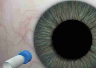 Calibre 25. Retina