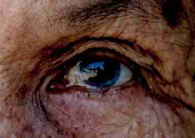 Banner Semana Mundial de Glaucoma 2020