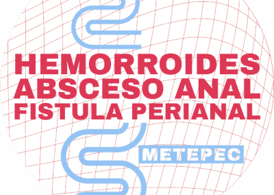Clínica de Hemorroides Metepec